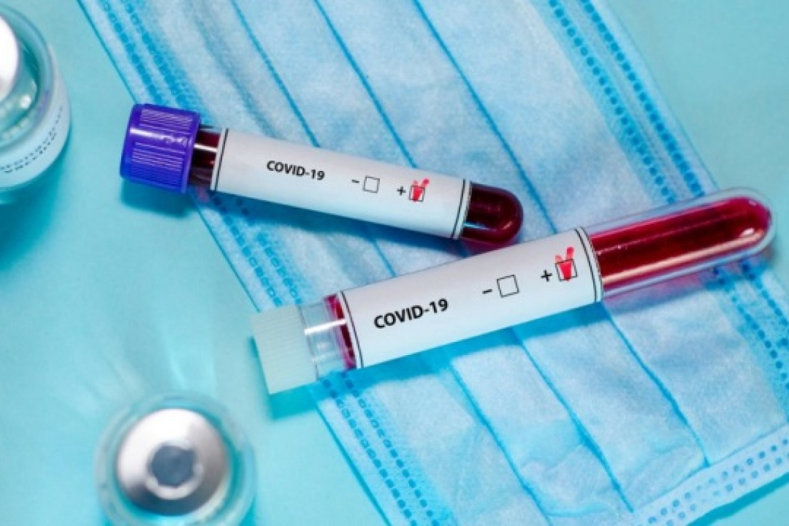 Житомирщина - в антирейтингу за кількістю нових випадків COVID-19 по Україні