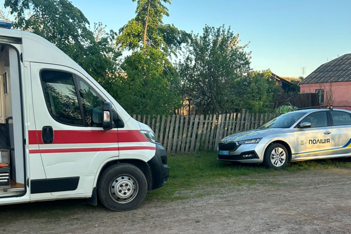 Множинні опіки тулуба та кінцівок - житель Житомирщини облив брата бензином і підпалив