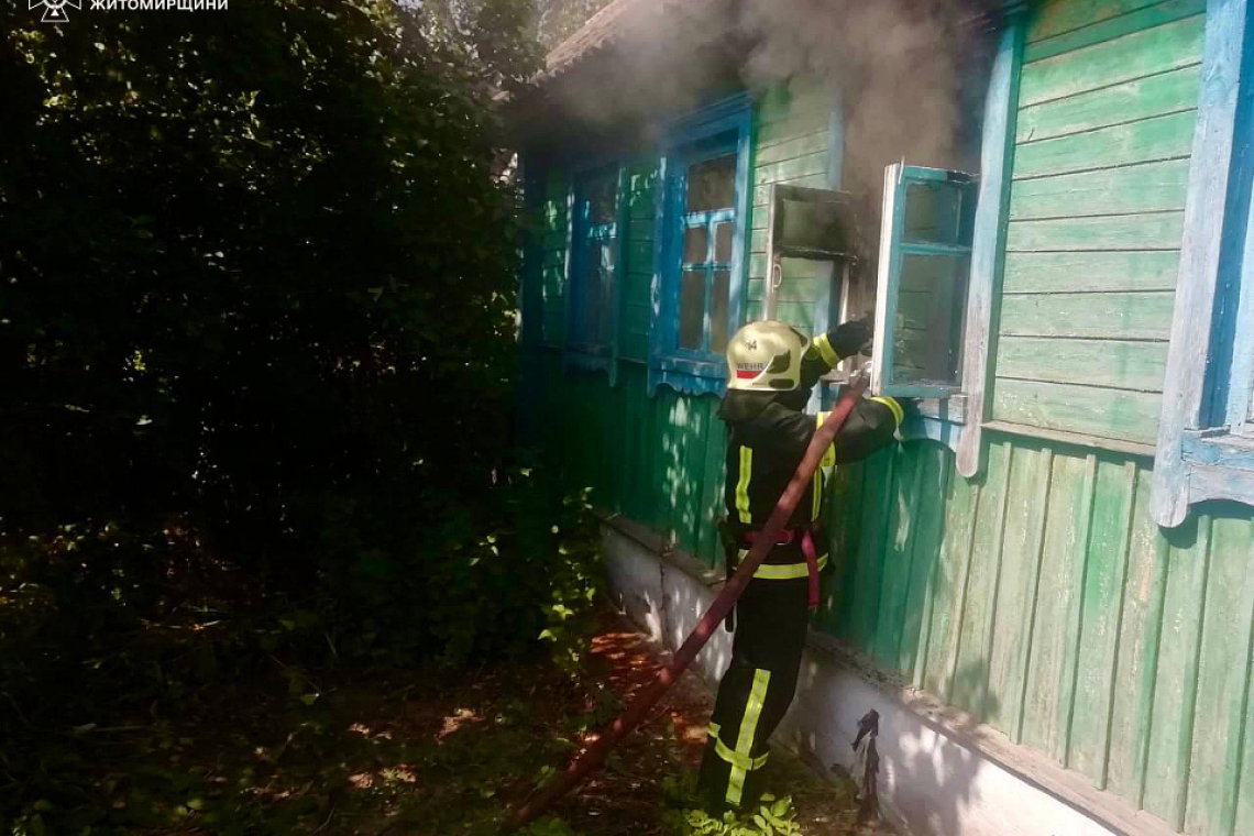 У селі Народицької громади під час пожежі травмувався чоловік