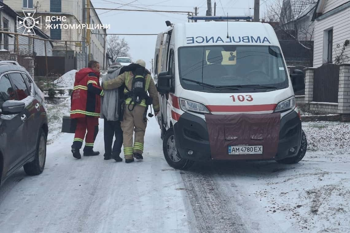 Намагався власноруч загасити: у Коростені на пожежі травмувався господар будинку