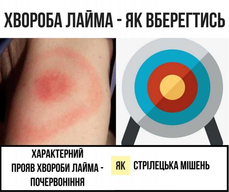 hvorlayma140725 2