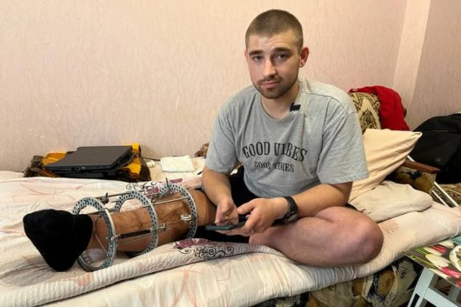 Ветеран війни з Коростеня, що має інвалідність, намагається отримати одноразову грошову допомогу від держави