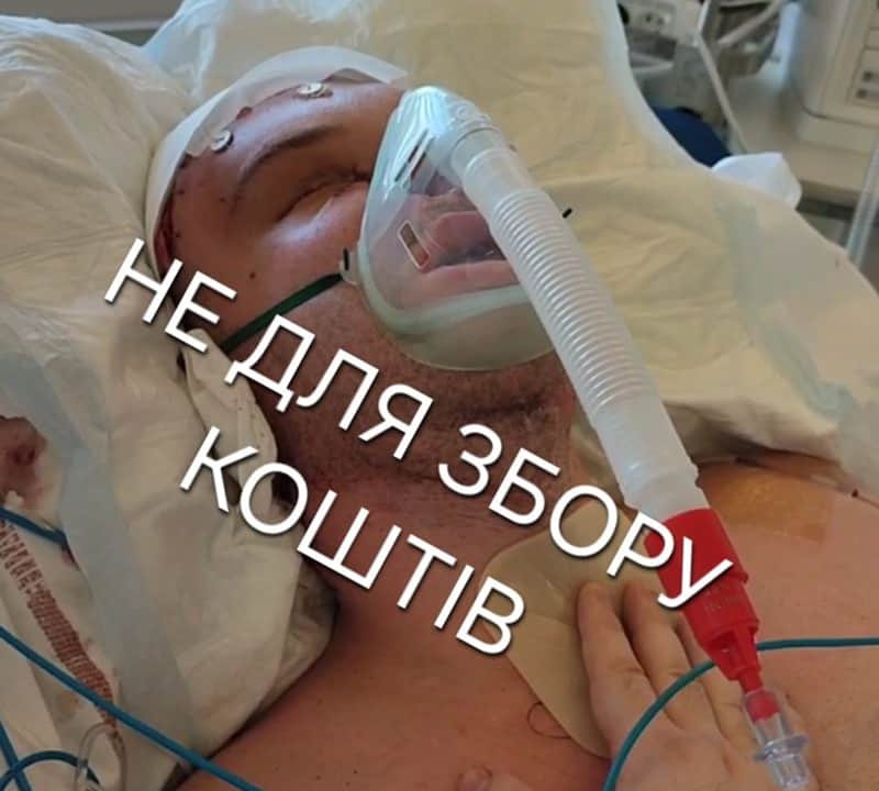 Захисник з Коростеня Владислав Кемський, який після операції був у тяжкому стані, вийшов з медикаментозного сну