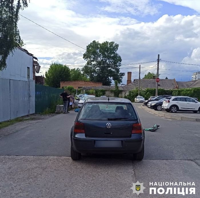 У Житомирі в ДТП травмовано підлітка на самокаті