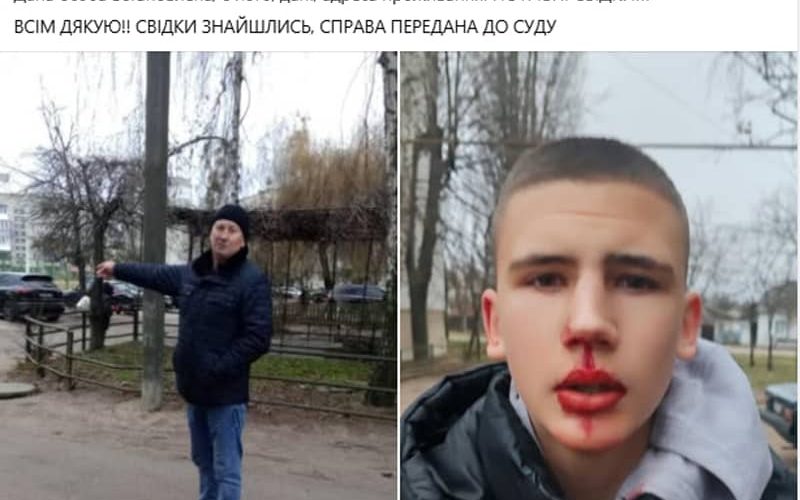 У Коростені п’яний чоловік напав на підлітка й зламав носа: що відомо
