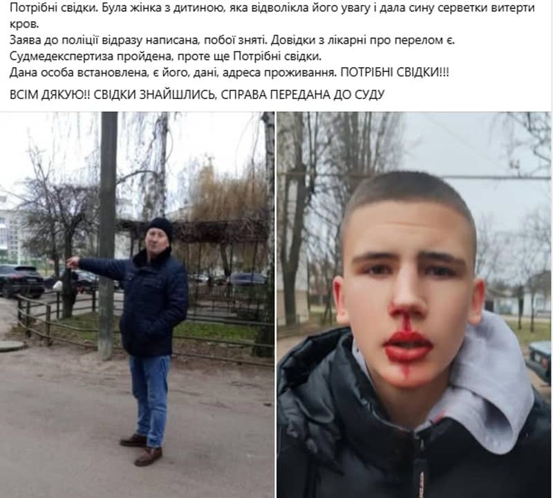 У Коростені п’яний чоловік напав на підлітка й зламав носа: що відомо
