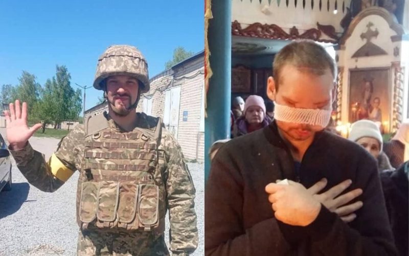 Тато казав, якби був вибір, то краще бути без рук, чим без очей, – військовий з Коростеня, якому реконструюють обличчя