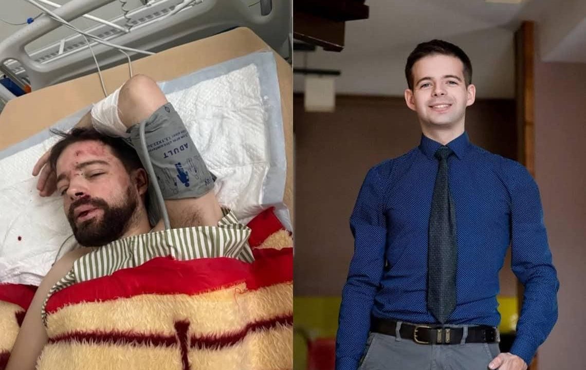На трасі в Житомирській області виявили мобілізованого львівського лаборанта: звідки у чоловіка травми голови