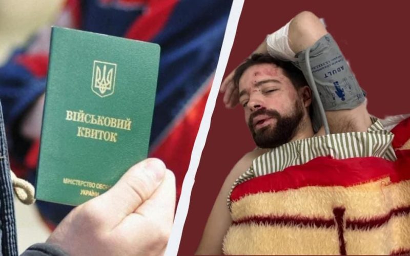 Житомирські лікарі розповіли про стан 27-річного мобілізованого львів’янина, якого знайшли на автотрасі