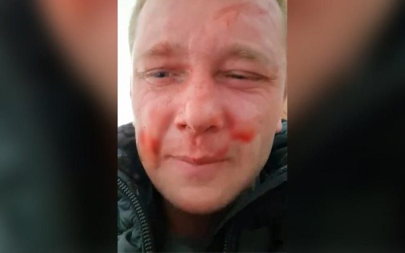 Житель Житомирщини каже, що його вдарили в ТЦК: у Центрі комплектування переконують – маніпуляція