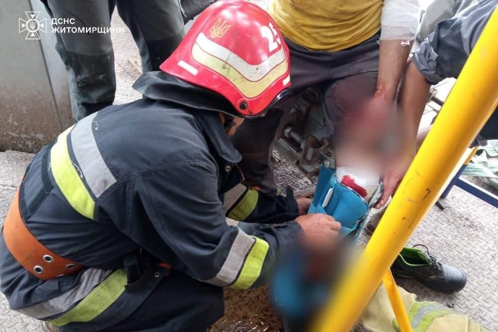 На Житомирщині чоловік зірвався під час ремонтних робіт – рятувальники транспортували з висоти 25 метрів