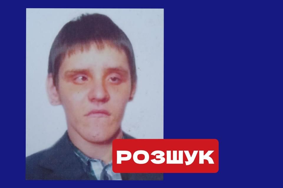 В Овруцькій громаді розшукують Миколу Старовойта: погано розмовляє та хворіє на ДЦП