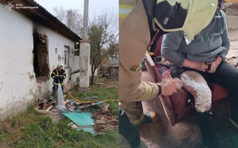 На Овруччині під час пожежі травмувалася 54-річна жінка