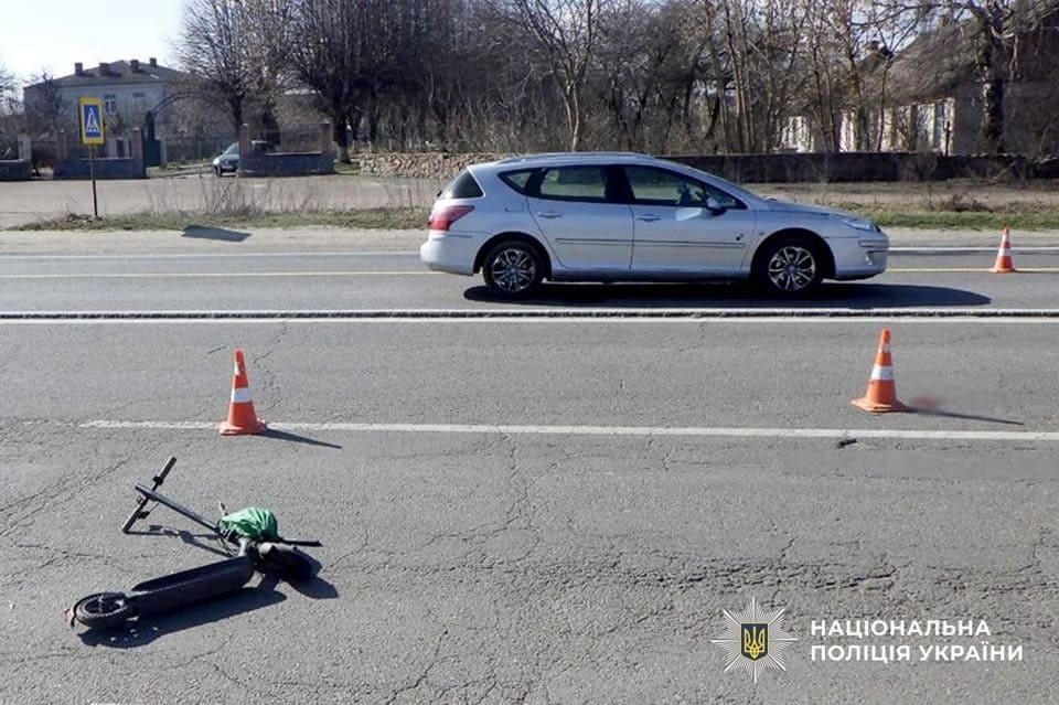 На Житомирщині авто збило 11‑річного хлопця на електросамокаті: дитина бореться за життя