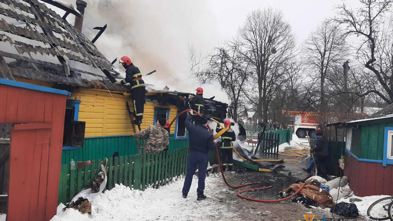 У селі Коростенського району на пожежі господар отримав опіки обличчя