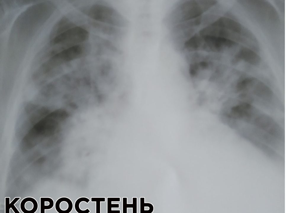 Коростенка поскаржилася на лікарів міської лікарні: що сталося