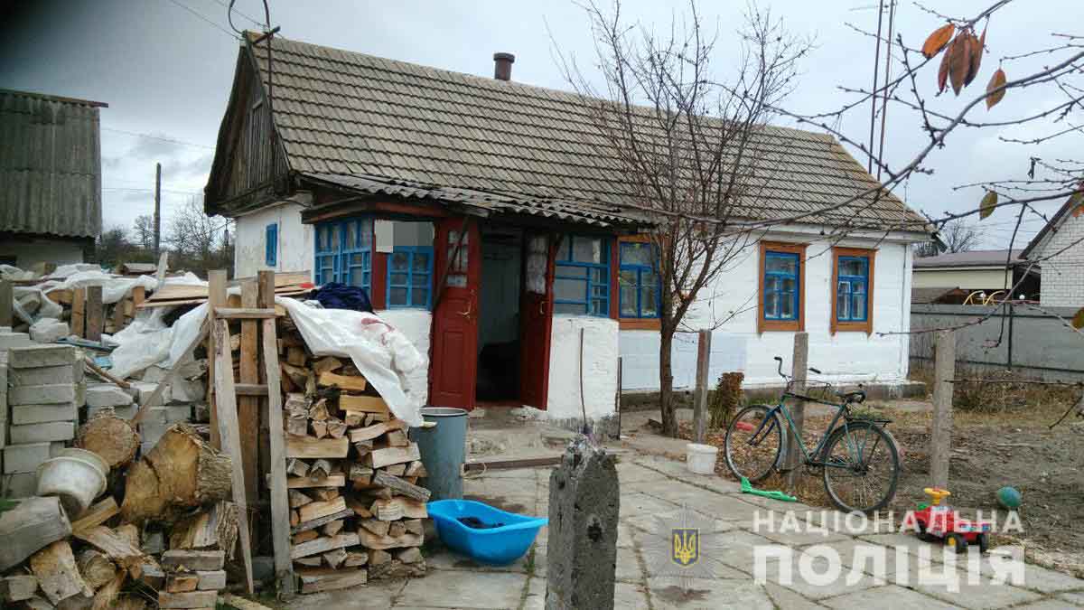 У Коростенському районі 4-річний хлопчик перелив на себе банку з окропом. Випадком зацікавилися в поліції